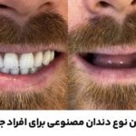 بهترین دندان مصنوعی برای جوانان: راهنمای تخصصی