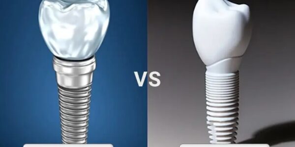 ایمپلنت تیتانیومی برای شما مناسب تر است یا ایمپلنت زیرکونیا؟