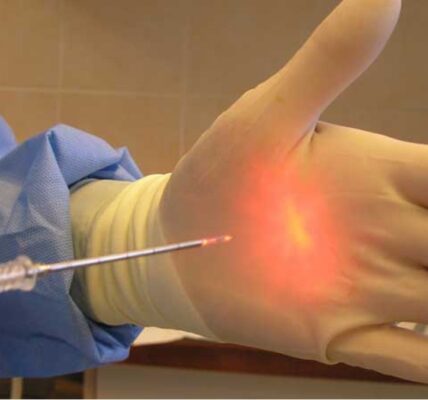 لیزر هموروئید؛ درمانی قطعی و فوری